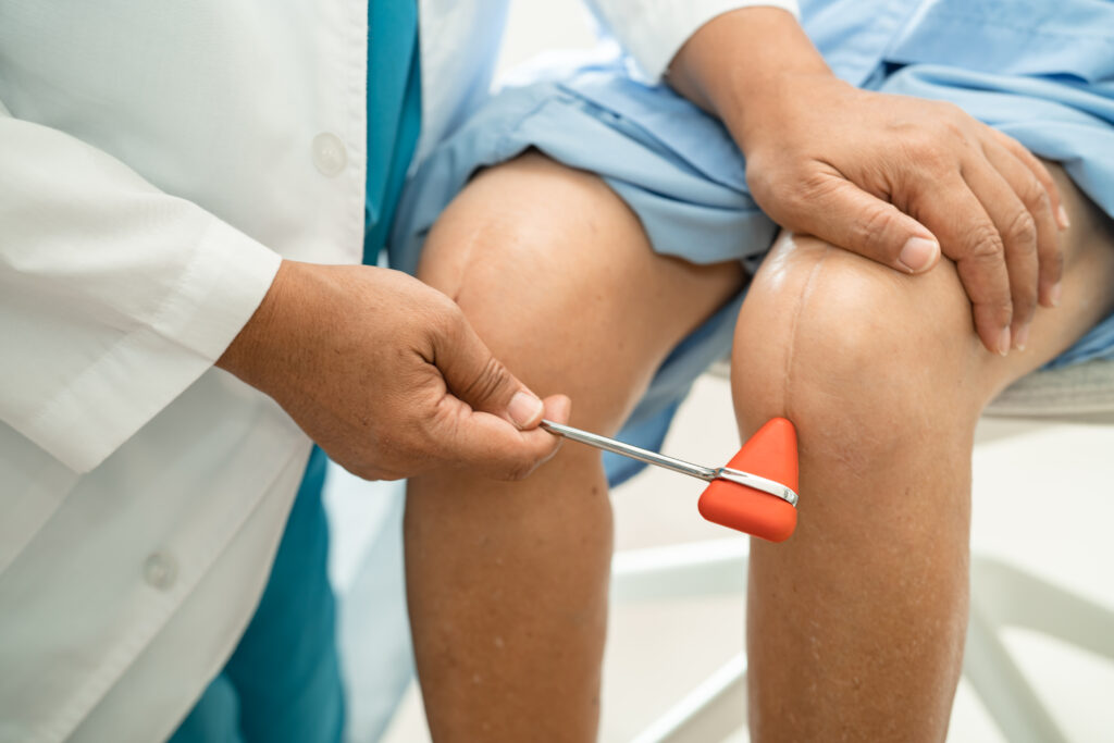 Asian doctor use hammer knock senior woman patient to check knee reflex, nerve and muscle in hospital.